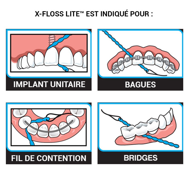 X-Floss lite - uofti.com
