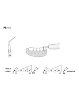 Insert P5 compatible EMS ultrarésistant UR - WOODPECKER - uofti.com