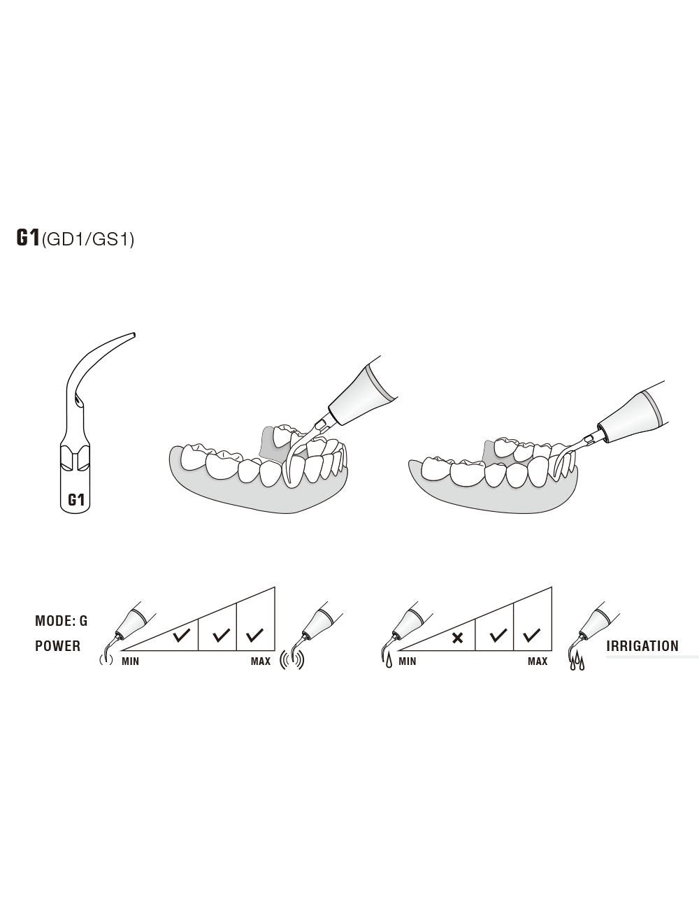 Insert G1 compatible EMS ultrarésistant UR - WOODPECKER - uofti.com