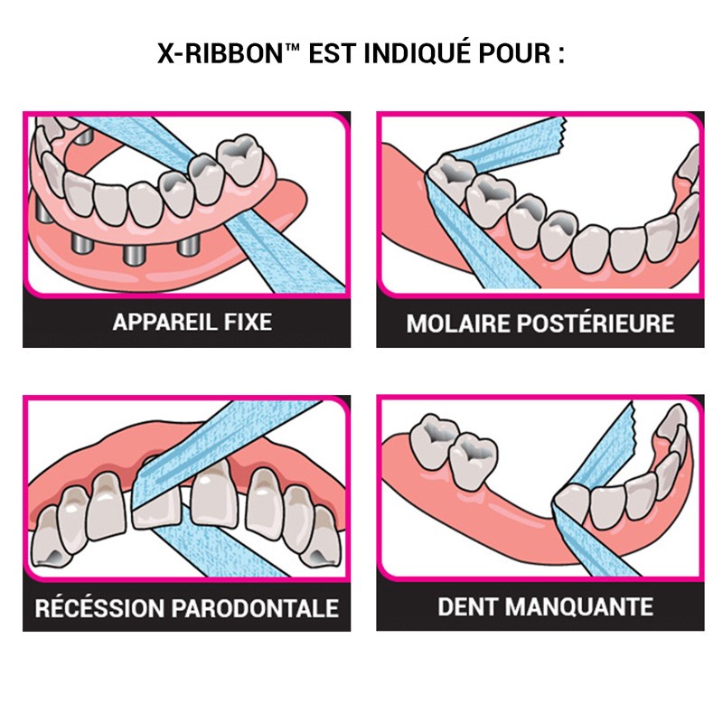X-Ribbon - uofti.com