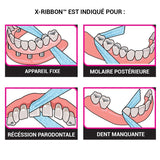 X-Ribbon - uofti.com