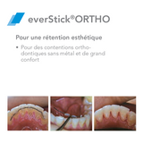 EverStick ORTHO Glasvezel - GC