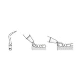 Insert PD4 compatible Satelec - WOODPECKER - uofti.com