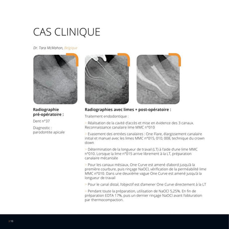 Lot de 6 limes One Curve - 6% conicité MicroMega - Dental Coop