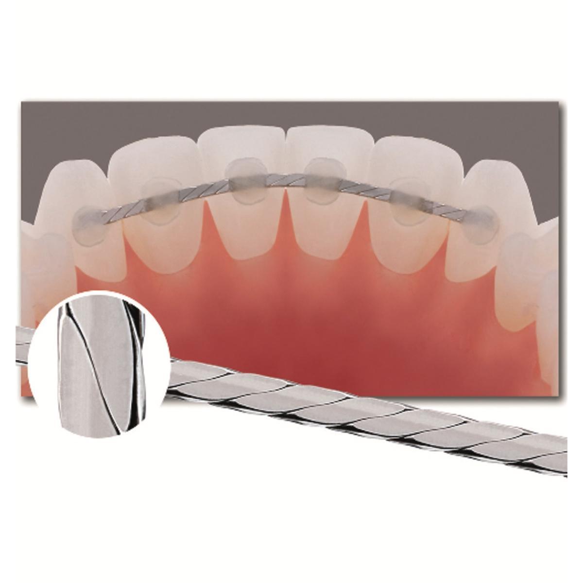 Alambre de retención trenzado - G&H Orthodontics